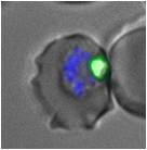 Plasmodium falciparum dans un globule rouge vu en contraste de phase ; en vert la vacuole digestive du parasite, en bleu son noyau – source Lise Musset.