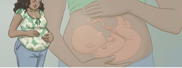 Description clinique de l’infection à virus Zika pendant la grossesse